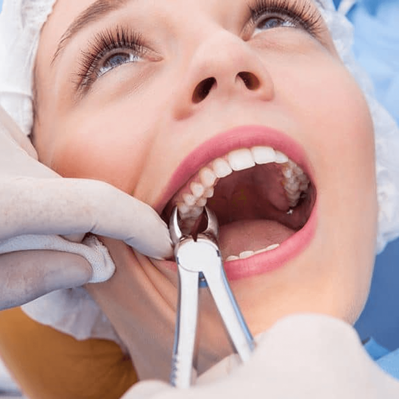 https://www.brightondc.com/wp-content/uploads/2023/08/Tooth-Extractions.png