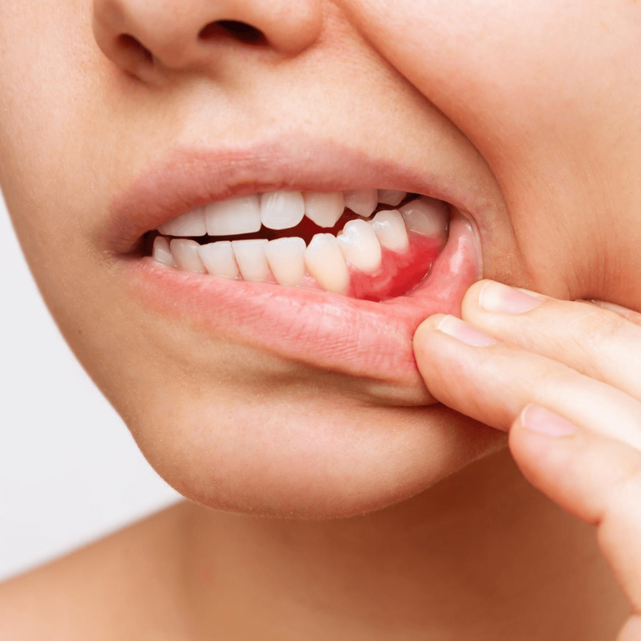 https://www.brightondc.com/wp-content/uploads/2023/08/What-is-Periodontal-Gum-Disease_.png
