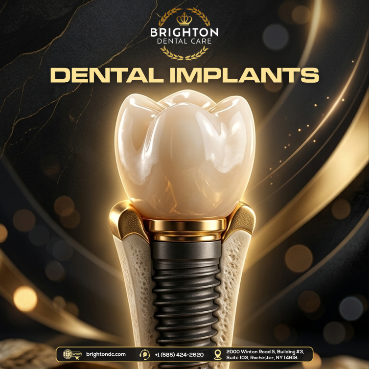 2026---May-Post-#-3---Dental-Implants